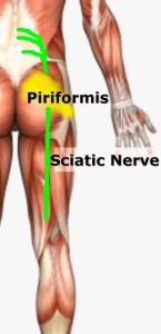 Back pain