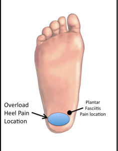 foot fat pad