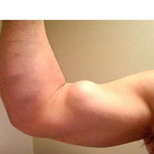 Physical Therapist