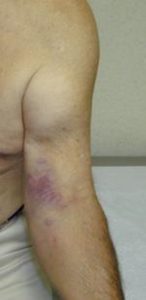 Physical Therapist