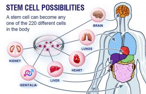 Stem cell treatment