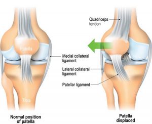 knee injuries