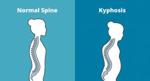 Physiotherapist - Pronation / Supination - Eddie O'Grady