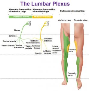 Lumbosacral Plexopathy