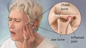 Temperomandibular Joint Disorder