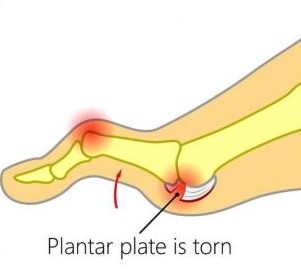 Physiotherapist - Pronation / Supination - Eddie O'Grady