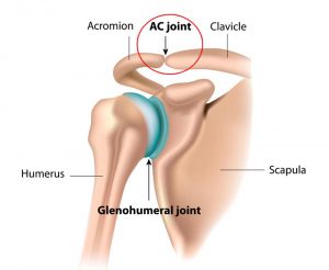 AC Joint Injuries 