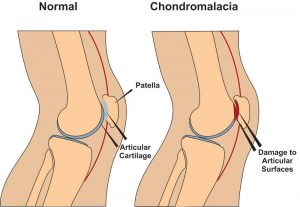 Physiotherapist - Pronation / Supination - Eddie O'Grady